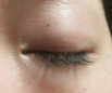 eye_closed.jpg